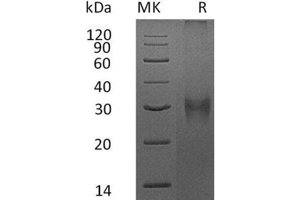 Fibrillin 1 Protein (FBN1) (His tag)