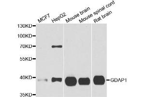 Western blot analysis of extracts of various cell lines, using GDAP1 antibody. (GDAP1 antibody)