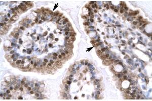 Rabbit Anti-EGR1 Antibody Catalog Number: ARP32241 Paraffin Embedded Tissue: Human Intestine Cellular Data: Epithelial cells of intestinal villas Antibody Concentration: 4. (EGR1 antibody  (N-Term))