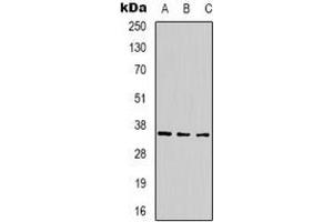 Western blot analysis of CABP2 expression in 293T (A), mouse brain (B), rat brain (C) whole cell lysates. (CABP2 antibody)