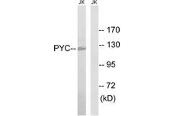 PC antibody  (AA 357-406)