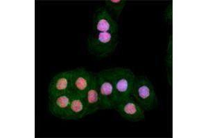 Immunofluorescence (IF) image for anti-Ataxia Telangiectasia Mutated (ATM) (phosphorylated) antibody (ABIN2666314) (ATM antibody  (phosphorylated))