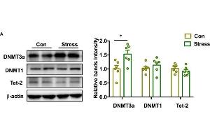 Effect of PS on DNMT and demethylase in adolescence. (TET2 antibody  (AA 1833-2002))