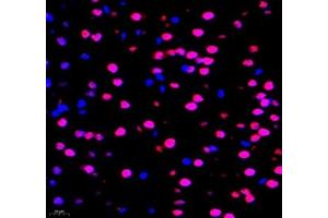 Immunofluorescence of paraffin embedded mouse brain using TCEAL3 (ABIN7075951) at dilution of 1:700 (400x lens) (TCEAL3 antibody)