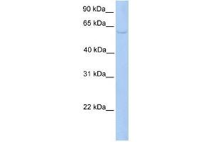 PWP1 antibody used at 0. (PWP1 antibody  (C-Term))