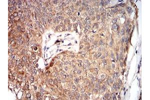Immunohistochemistry (IHC) image for anti-VP2 (AA 296-438) antibody (ABIN5862415) (VP2 (AA 296-438) antibody)