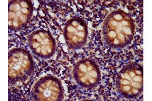 IHC image of ABIN7151786 diluted at 1:400 and staining in paraffin-embedded human appendix tissue performed on a Leica BondTM system.