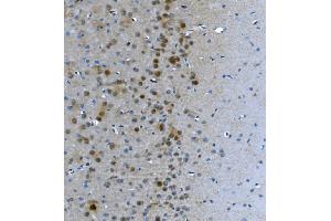 IHC analysis of LSM7 using anti-LSM7 antibody (ABIN7598937). (LSM7 antibody  (AA 1-103))