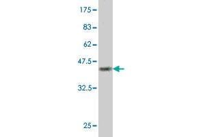 Western Blot detection against Immunogen (37. (PAP Associated Domain Containing 7 (PAPD7) (AA 2-110) antibody)