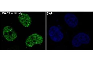 Immunofluorescence (IF) image for anti-Histone Deacetylase 9 (HDAC9) antibody (ABIN7606922)