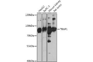 Western blot analysis of extracts of various cell lines, using TR antibody (ABIN1683134, ABIN5664756, ABIN5664758 and ABIN6220605) at 1:3000 dilution. (TRAP1 antibody  (AA 445-704))