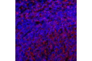 anti-Membrane-Spanning 4-Domains, Subfamily A, Member 1 (MS4A1) antibody
