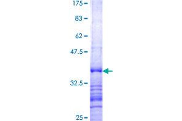 SEMA3B Protein (AA 651-748) (GST tag)