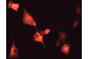 Immunofluorescence - anti-Venus Ab in 293HEK Cells with Venus Protein at 1/50 dilution, Cells were fixed With 4% of PFA (GFP antibody)