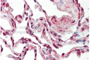 Rabbit Anti-SRSF9 antibody Catalog Number: ARP40490 Formalin Fixed Paraffin Embedded Tissue: Human Adult Lung  Observed Staining: Cytoplasm in hepatocytes Primary Antibody Concentration: 1:600 Secondary Antibody: Donkey anti-Rabbit-Cy3 Secondary Antibody Concentration: 1:200 Magnification: 20X Exposure Time: 0. (SFRS9 antibody  (Middle Region))