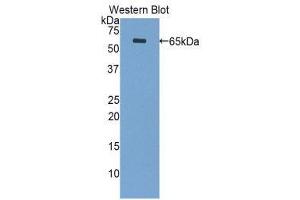 Western Blotting (WB) image for anti-Periplakin (PPL) (AA 1439-1716) antibody (ABIN1860293) (PPL antibody  (AA 1439-1716))