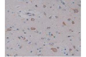 IHC-P analysis of Human Brain Tissue, with DAB staining. (NPY antibody  (AA 30-97))