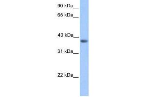 Transfected 293T; WB Suggested Anti-NEUROD6 Antibody Titration: 0. (NEUROD6 antibody  (Middle Region))
