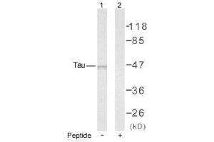 Image no. 1 for anti-Microtubule-Associated Protein tau (MAPT) (Ser235) antibody (ABIN197260) (MAPT antibody  (Ser235))