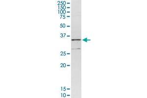 CENPH MaxPab rabbit polyclonal antibody. (CENPH antibody  (AA 1-247))