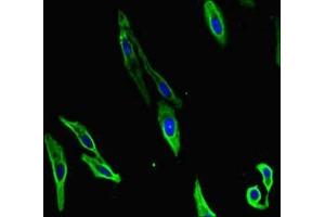 Immunofluorescent analysis of Hela cells using ABIN7155449 at dilution of 1:100 and Alexa Fluor 488-congugated AffiniPure Goat Anti-Rabbit IgG(H+L) (CARM1 antibody  (AA 209-379))