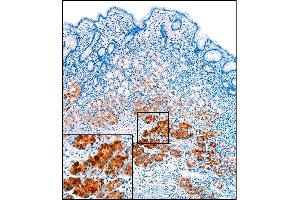 Immunohistochemistry (IHC) image for anti-Pepsinogen A antibody (ABIN108409) (Pepsinogen A antibody)