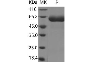 Western Blotting (WB) image for Interleukin 22 Receptor, alpha 1 (IL22RA1) protein (Fc Tag,ECD) (ABIN7196511) (IL22 Receptor alpha 1 Protein (Fc Tag,ECD))