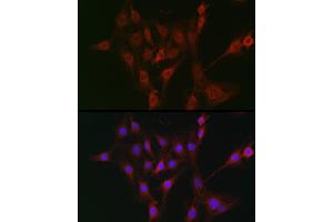Immunofluorescence analysis of C6 cells using T Rabbit pAb (ABIN3022236, ABIN3022237, ABIN3022238, ABIN1513586 and ABIN6218687) at dilution of 1:100 (40x lens).