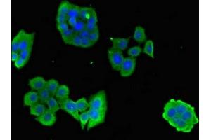 Immunofluorescent analysis of PC-3 cells using ABIN7146768 at dilution of 1:100 and Alexa Fluor 488-congugated AffiniPure Goat Anti-Rabbit IgG(H+L) (CPB2 antibody  (AA 225-372))