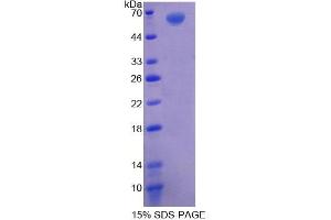 SDS-PAGE (SDS) image for Acylglycerol Kinase (AGK) (AA 15-300) protein (His tag,GST tag) (ABIN4990518)