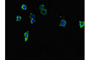 Immunofluorescent analysis of HepG2 cells using ABIN7171786 at dilution of 1:100 and Alexa Fluor 488-congugated AffiniPure Goat Anti-Rabbit IgG(H+L) (FAM46C antibody  (AA 1-391))