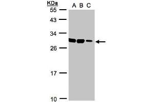 WB Image Sample(30 ug whole cell lysate) A:HeLa S3, B:Hep G2 , C:MOLT4 , 12% SDS PAGE antibody diluted at 1:1000 (ASB9 antibody)