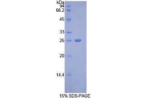SDS-PAGE analysis of Rat Connexin 43 Protein. (Connexin 43/GJA1 Protein)