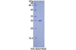 SDS-PAGE analysis of Rat Connexin 43 Protein. (Connexin 43/GJA1 Protein)