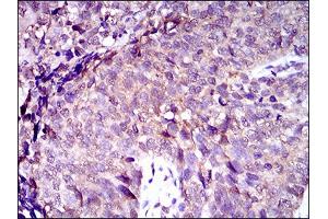 Immunohistochemistry (IHC) image for anti-ATP-Binding Cassette, Sub-Family C (CFTR/MRP), Member 4 (ABCC4) (AA 631-692) antibody (ABIN1724860)