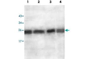 Western blot analysis of ES2 cell (Lane 1), EC109 cell (Lane 2), human fetal lung (Lane 3) and human fetal brain (Lane 4) lysate with AKR1A1 polyclonal antibody  at 1 : 500 dilution. (AKR1A1 antibody  (AA 132-310))
