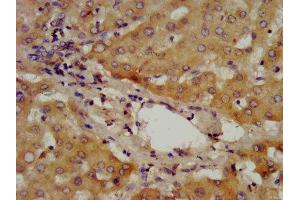 IHC image of ABIN7142878 diluted at 1:400 and staining in paraffin-embedded human liver tissue performed on a Leica BondTM system. (ADAMTS13 antibody  (AA 738-905))