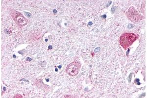 Anti-NR1D1 antibody  ABIN1049129 IHC staining of human brain, thalamus. (NR1D1 antibody  (Internal Region))