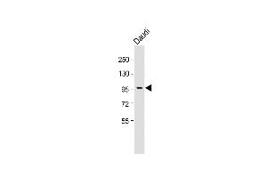 Anti-INB Antibody (C-term) at 1:1000 dilution + Daudi whole cell lysate Lysates/proteins at 20 μg per lane. (INPP5B antibody  (C-Term))