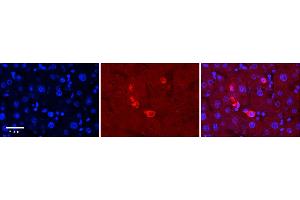 Rabbit Anti-MAPK7 Antibody  Catalog Number: ARP57731_P050 Formalin Fixed Paraffin Embedded Tissue: Human Adult Liver  Observed Staining: Cytoplasm in Kupffer cells only, strong signal, low tissue distribution Primary Antibody Concentration: 1:100 Secondary Antibody: Donkey anti-Rabbit-Cy3 Secondary Antibody Concentration: 1:200 Magnification: 20X Exposure Time: 0. (MAPK7 antibody  (Middle Region))