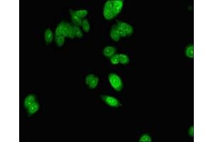 Immunofluorescent analysis of HepG2 cells using ABIN7154802 at dilution of 1:100 and Alexa Fluor 488-congugated AffiniPure Goat Anti-Rabbit IgG(H+L) (NHP2 antibody  (AA 1-153))