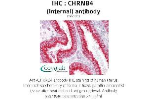 Image no. 1 for anti-Cholinergic Receptor, Nicotinic, beta 4 (Neuronal) (CHRNB4) (Internal Region) antibody (ABIN1733076) (CHRNB4 antibody  (Internal Region))