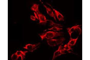 ABIN6267634 staining Hela by IF/ICC. (GRIN2B antibody  (pTyr1474))