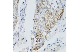 Immunohistochemistry (IHC) image for anti-Sirtuin 2 (SIRT2) (AA 288-389) antibody (ABIN3020852)