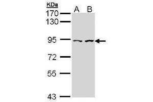 WB Image Sample (30 ug of whole cell lysate) A: Hela B: Hep G2 , 7. (CTNNAL1 antibody  (Internal Region))