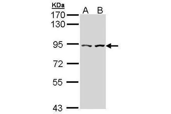 CTNNAL1 anticorps  (Internal Region)