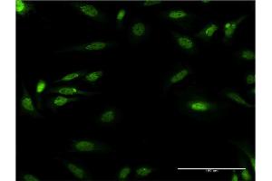 Immunofluorescence (IF) image for anti-Damage Specific DNA Binding Protein 1 (DDB1) (AA 1044-1140) antibody (ABIN514914)