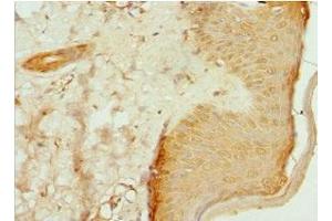 Immunohistochemistry of paraffin-embedded human skin tissue using ABIN7147369 at dilution of 1:100 (ITGB3BP antibody  (AA 1-177))