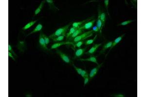 Immunofluorescence staining of Hela cells with ABIN7159800 at 1:125, counter-stained with DAPI. (m1ip1 antibody  (AA 1-183))