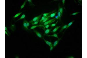 Immunofluorescence staining of Hela cells with ABIN7159800 at 1:125, counter-stained with DAPI.